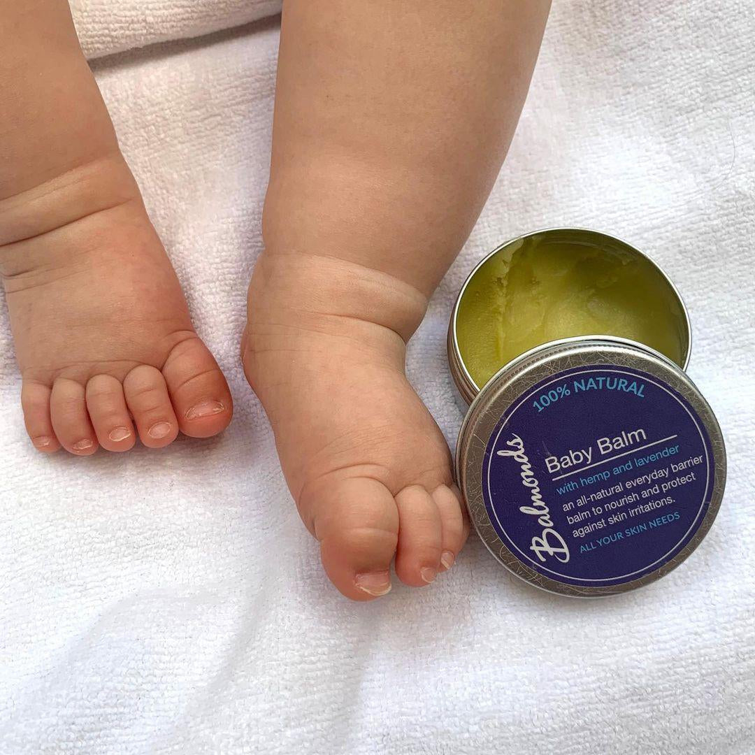 Guide to Baby Eczema; Causes, Treaments and Advice - Natural Baby Shower